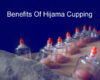 Hijama cupping therapy benefits